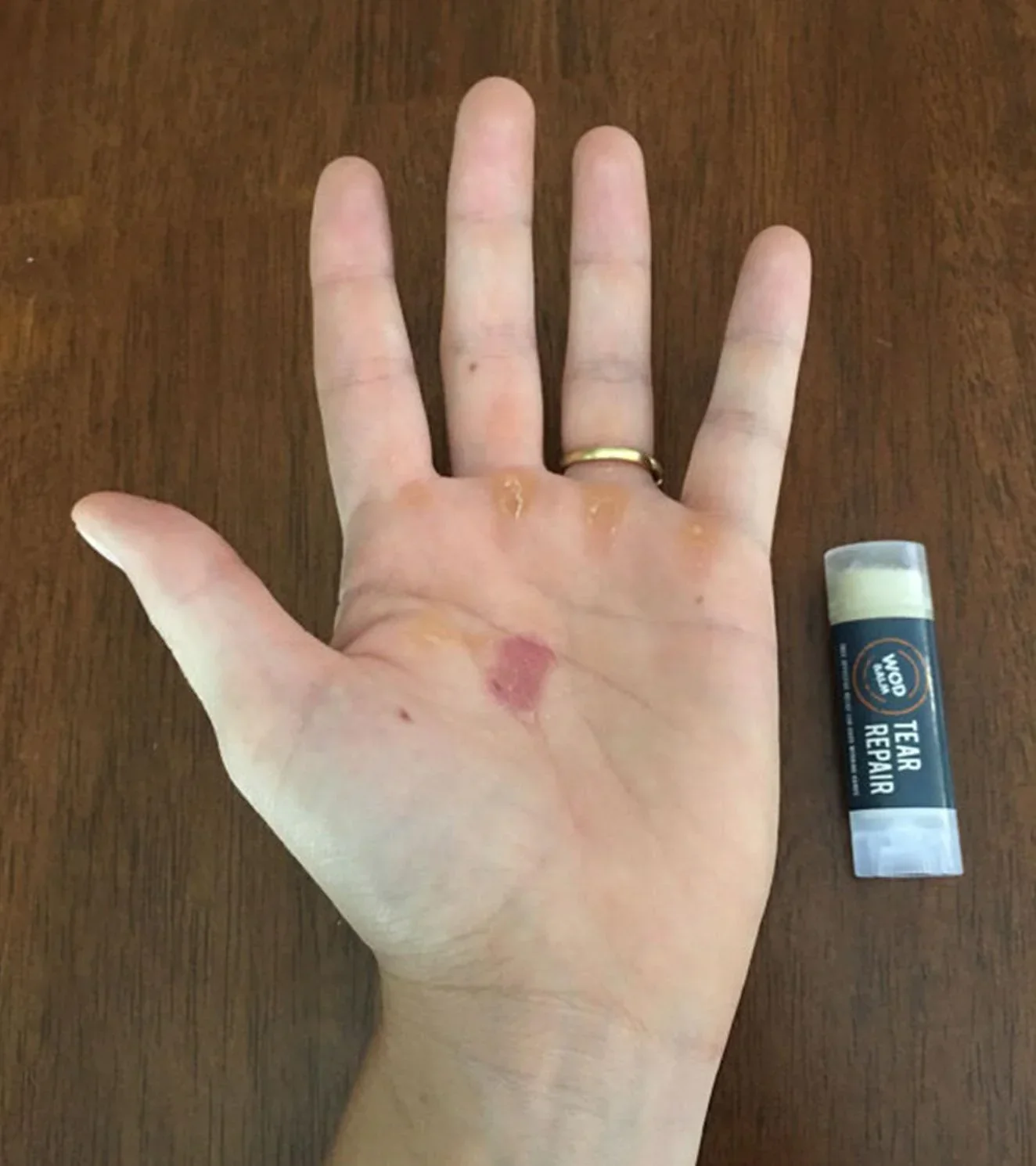 WOD Balm gift pack - Image 3